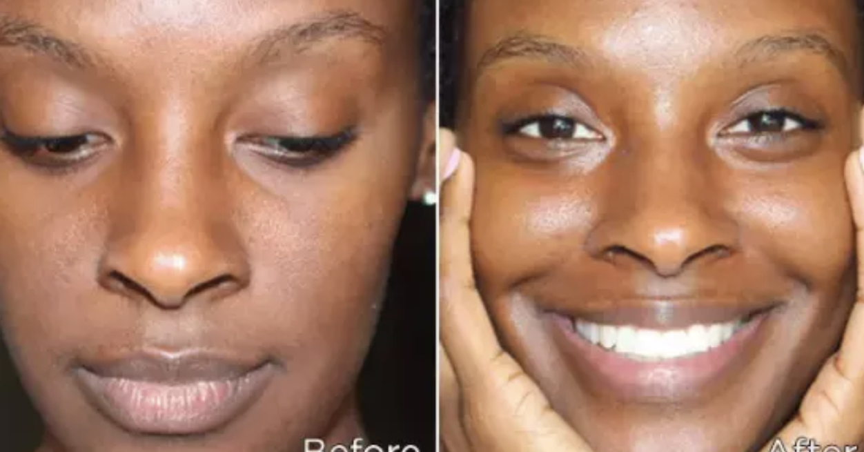 Face Masks Before After Photos That Will Have You Reaching For Your Wallet