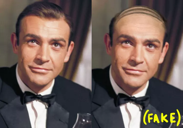 Sean Connery wore a toupee when he played James Bond.