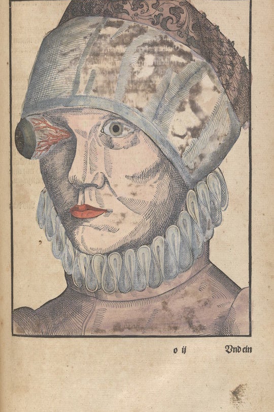 It may sound like something out of a horror movie, but self-enucleation (or autoenucleation) is a very real and unfortunate psychiatric emergency. It's rare, and in the past 50 years, there have been over 50 cases of complete or partial self-enucleation in English medical journals, according to a 2012 study published in the British Journal of Ophthalmology. What would drive someone to commit such a violent act of self-harm? Psychosis, or the loss of touch with reality. "All of these patients have had a psychotic episode and developed delusions about their eyes," Matthew Large, coauthor of the study and conjoint professor of psychiatry at the University of New South Wales in Sydney, told BuzzFeed News. Just last December, a Colorado prisoner grew out his fingernails and removed his eyes after guards allegedly ignored his psychotic episodes, the Guardian reported. The symptoms of psychosis include hallucinations, or hearing things that are not present; delusions, or strongly-held false beliefs; and cognitive impairment, or the inability to think logically. "People who remove their eyes due to psychosis often believe that they can see evil or they are casting evil," Large said. Similar to Muthart, many patients believe their eyes pose a threat to their loved ones.