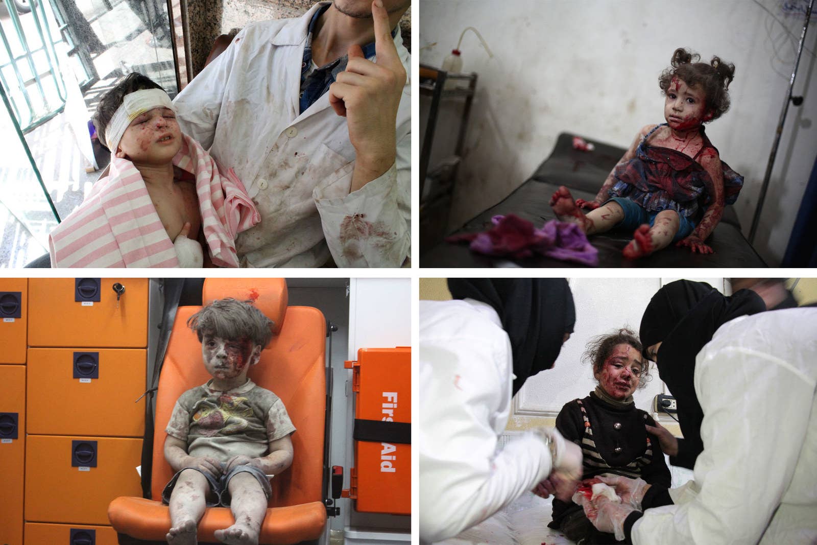 Top left, a wounded Syrian child receives medical treatment at a hospital in Aleppo, 2012. Top right, an injured girl is treated at a makeshift hospital in Douma, 2014. Bottom left, Omran Daqneesh sits alone in the back of the ambulance after he got injured during air strikes, Aleppo, 2016. Bottom right, a Syrian girl receives treatment at a make-shift hospital in Douma, 2018.
