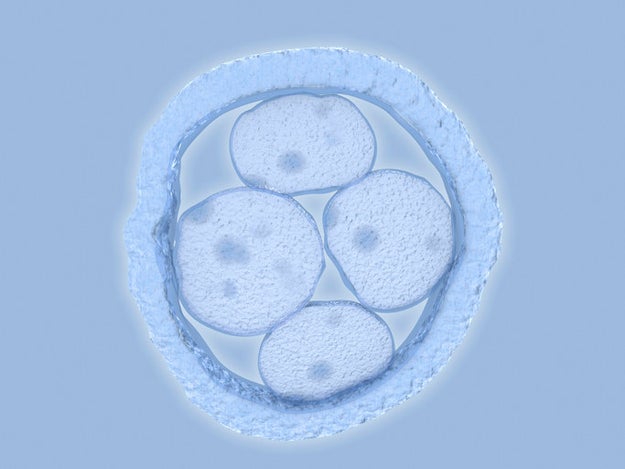 Chimerism is a rare genetic condition caused by the fusion of two embryos in the womb.