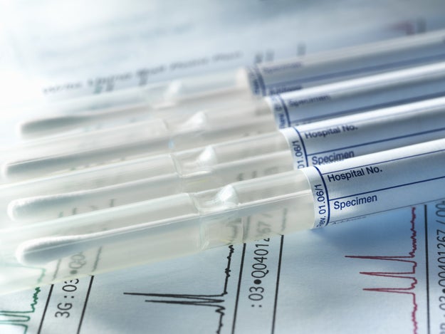 Chimerism can also cause a lot of confusion when it comes to genetic tests for, say, paternity.