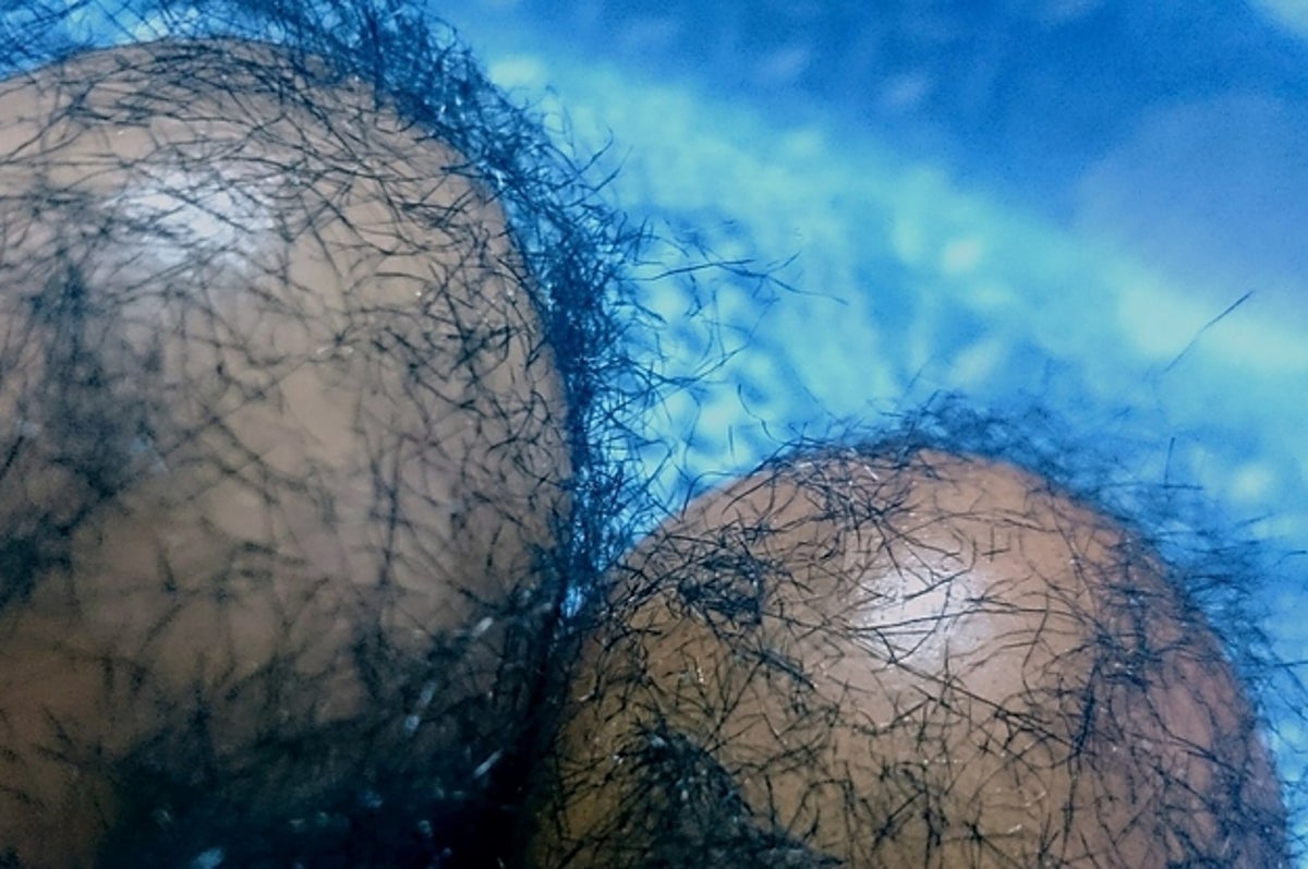 We Dare You To Make It Through This List Of 23 Gross And Hairy Photos Taken  Straight From The Armpit Of The Internet