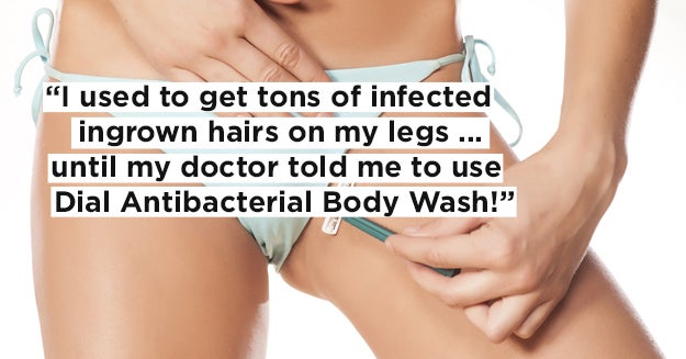 10 Products That Get Rid Of Ingrown Hairs Tried And Proven By