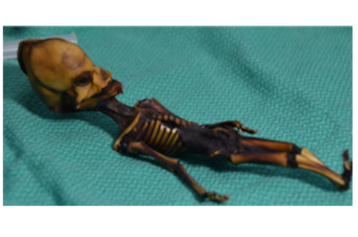 15年前に発見された「宇宙人」の骸骨、真実は悲劇の物語だった