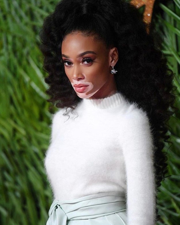 This isn't the first time Harlow has spoken out against only being referred to as the model with vitiligo. In an interview with Elle back in 2016, Harlow said, "I am literally just a human. I have the same brain as you; there’s a skeleton under my skin just like yours. It’s not that serious."