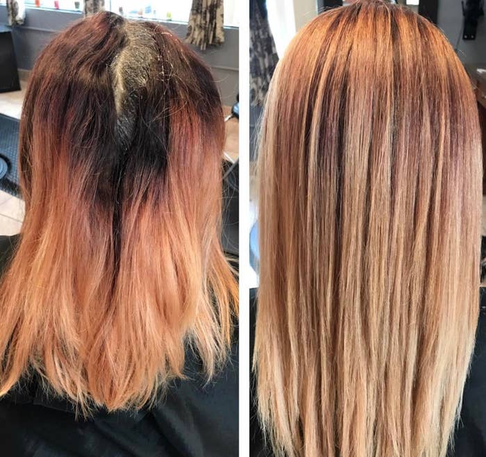 Hair Growth Treatments Archives Less Laparos Copy