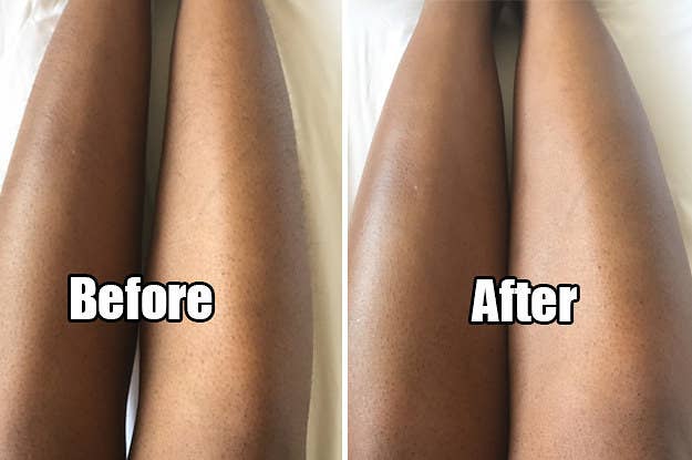 I Tried An All Natural Hair Removal Treatment And I M Never Gonna
