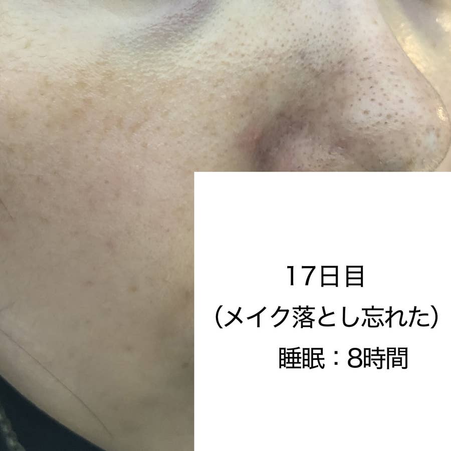 30歳が美肌になれるか1カ月がんばってみたら気づいた4つのこと 30歳が美肌になれるか1カ月がんばってみたら気づいた4つのこと