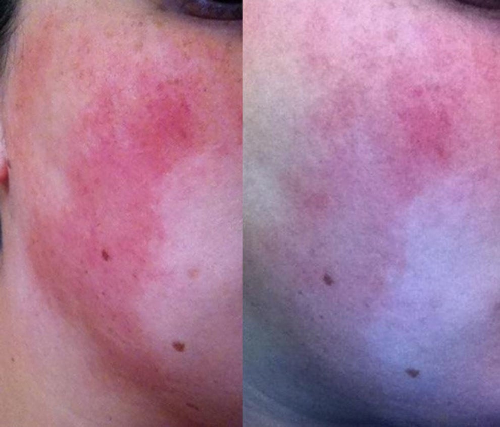 14 Face Masks With Before And After Photos That Will Have You Reaching For Your Wallet