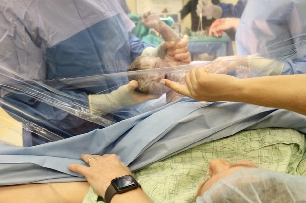 Not every hospital offers a clear drape, and if they do, you have to ask ahead of time.