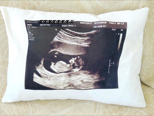 18 Unforgettable Things You Can Do With Your Baby's Ultrasound Photos