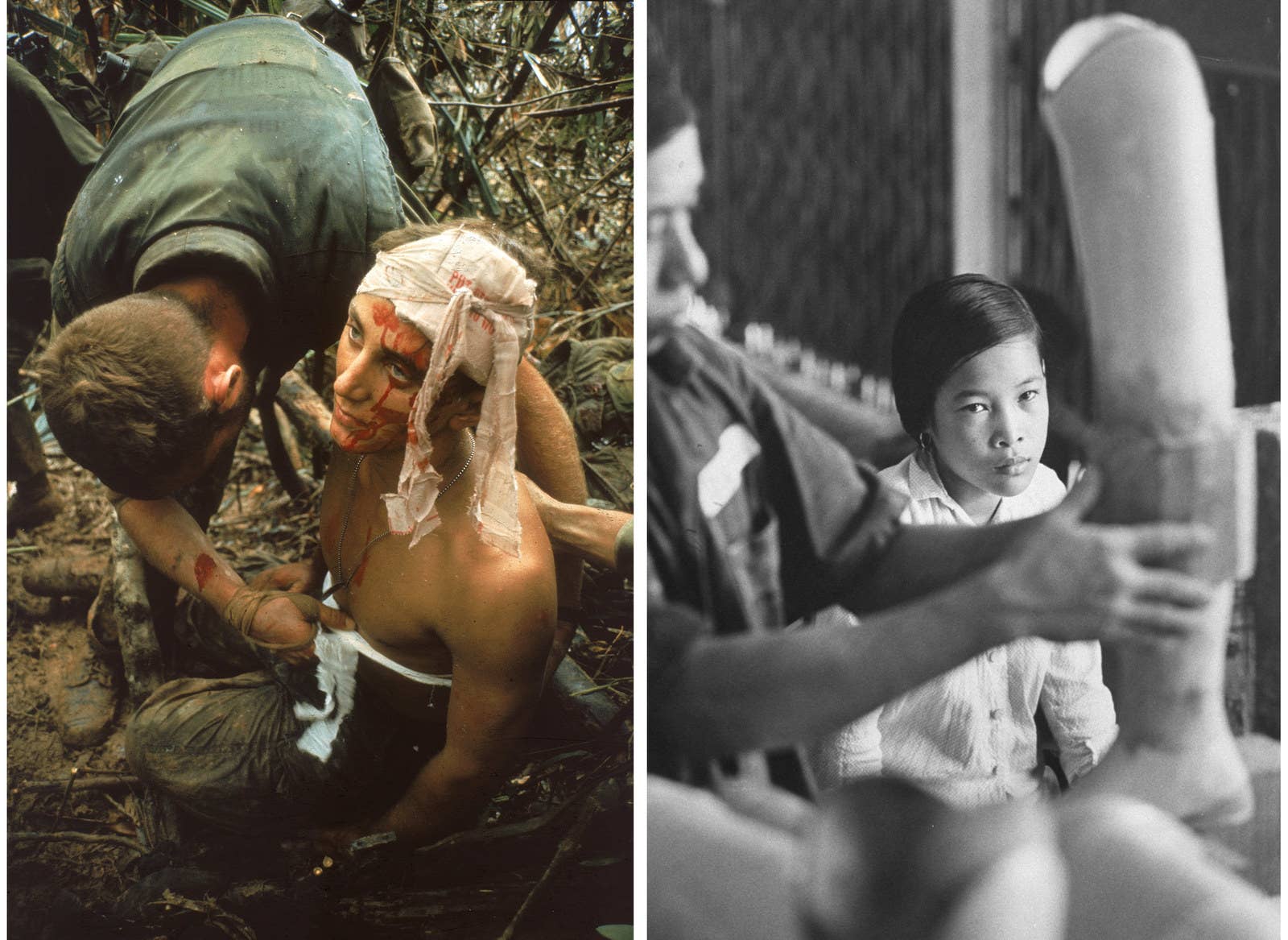 À esquerda, um combatente americano em estado de choque recebe atendimento durante a Operação Prairie. À direita, a jovem vietnamita Nguyen Thi Tron, que perdeu uma das pernas durante um ataque americano à sua vila, observa a prótese que estava sendo feita para ela.