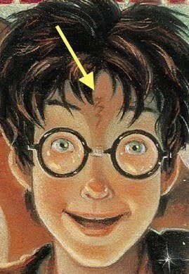 Wait, Where Was Harry Potter'S Lightning Scar?