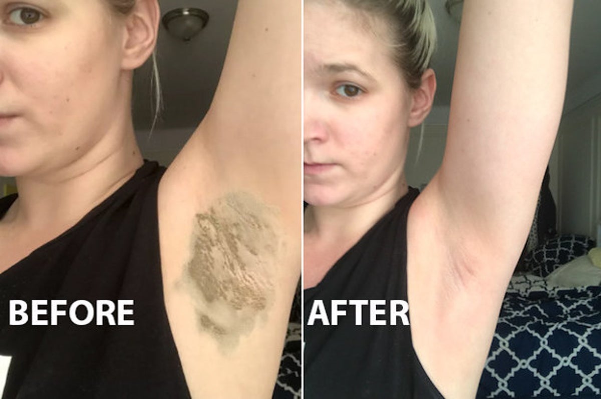 You Switch To Natural Deodorant, Try An Armpit Detox
