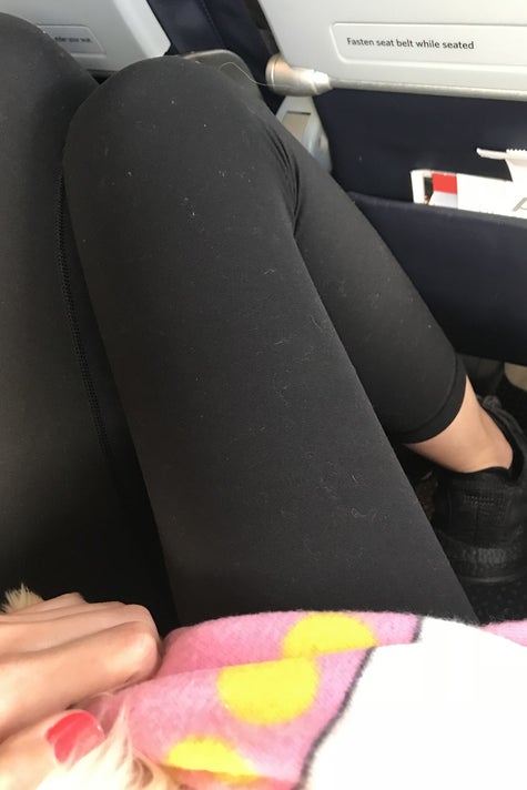 I Have Endometriosis And These Leggings Are The Only Kind I Will Wear