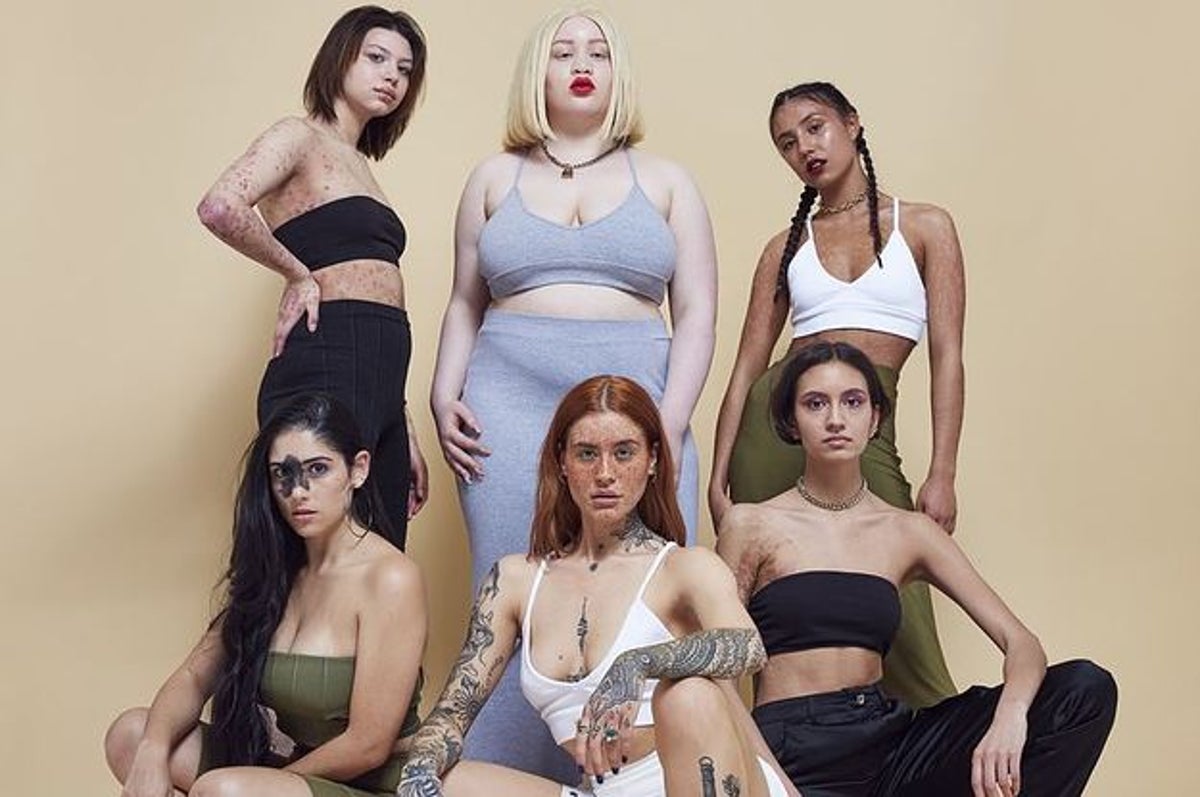 Missguided's Body Positive Campaign Is All About Embracing Your 'Flaws