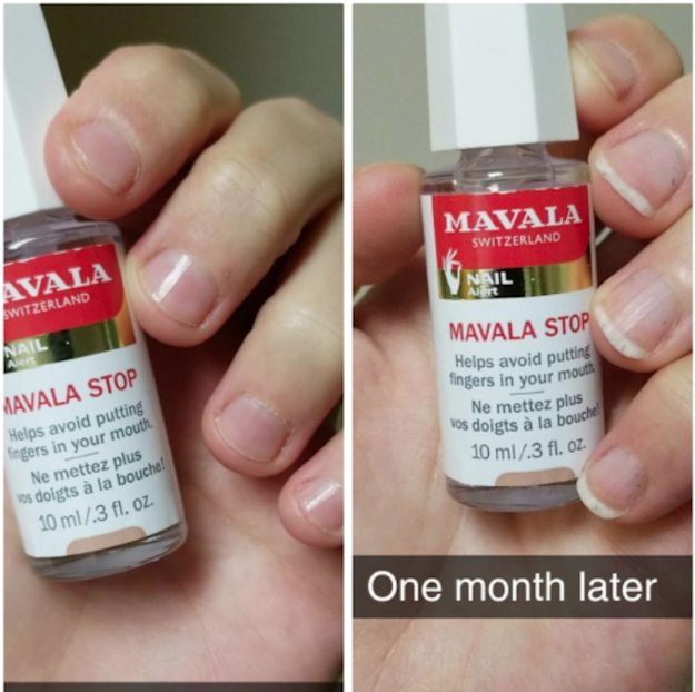 Amazon.com : SuperNail Bite No More : Nail Treatment Products : Beauty &  Personal Care