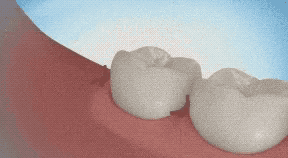 anigif_sub-buzz-27267-1526292945-1.gif
