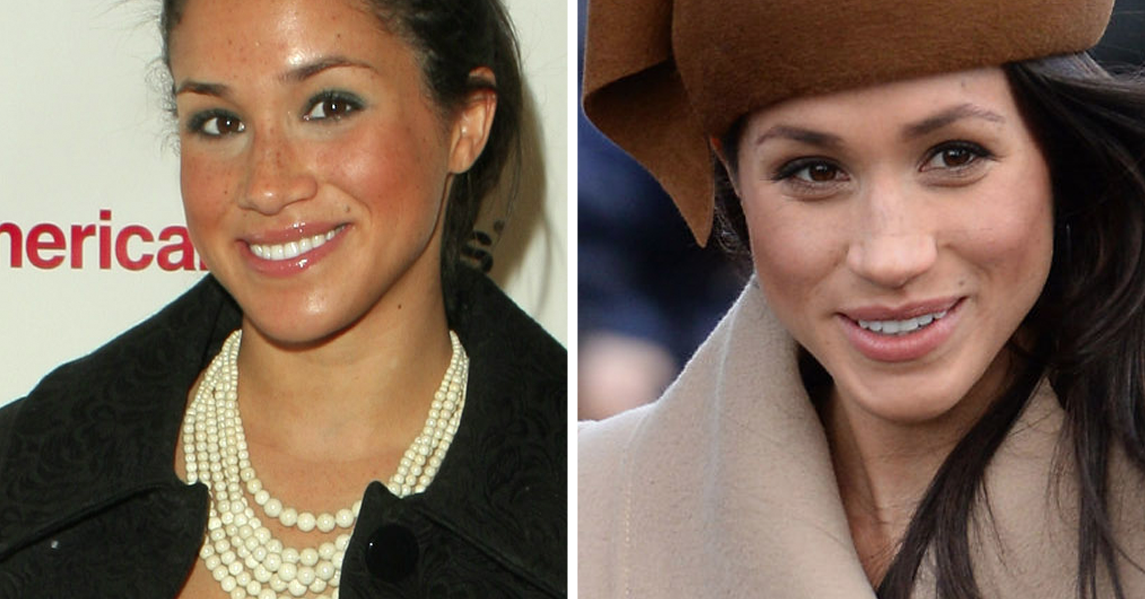 Meghan Markle Enceinte Schwanger Meghan Markle Now And Then