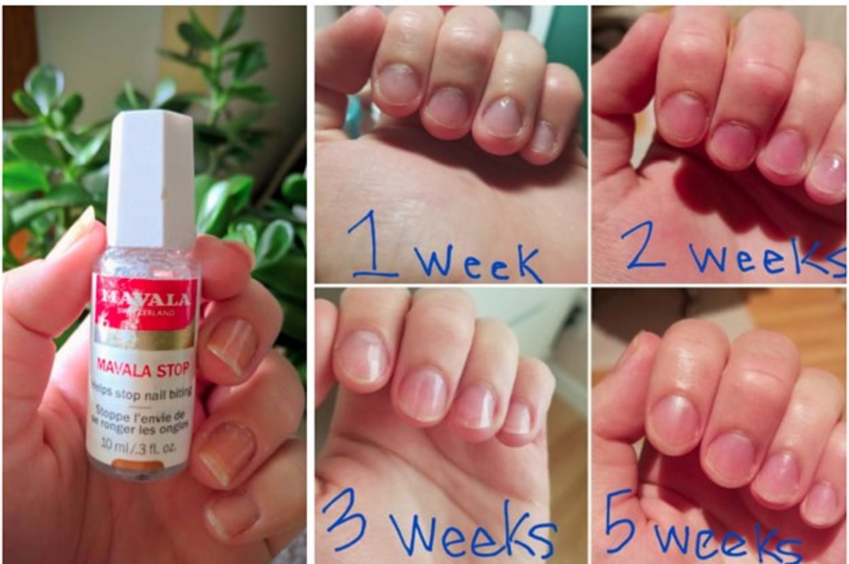 This Miracle Polish Just Might Get You To Stop Biting Your Nails
