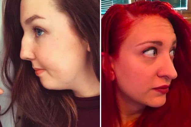 Secréte lampe Hylde People Are Sharing Side Profile Selfies To Prove That All Noses Are  Beautiful
