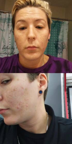 Over 1 000 People Swear By This Under 5 Soap And My Skin Is Ready