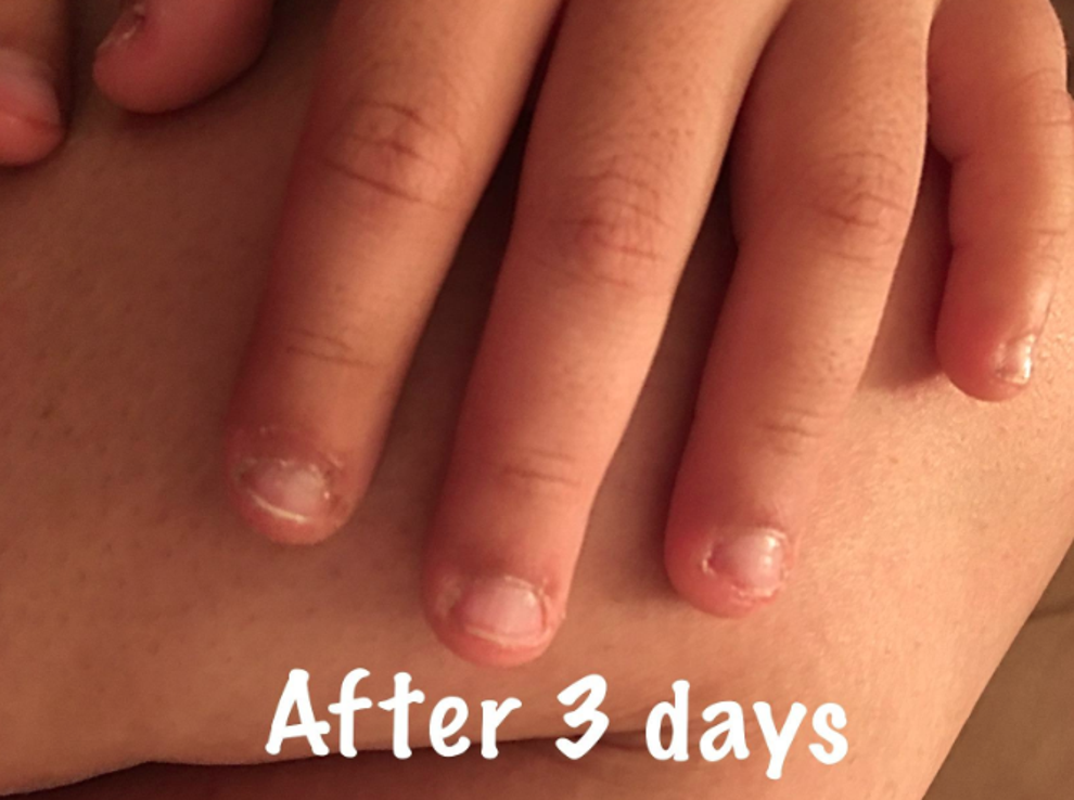 This Miracle Polish Just Might Get You To Stop Biting Your Nails