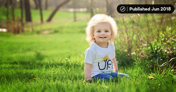 Uncombable Hair Syndrome Is A Real Super Rare Genetic Condition And This Baby Has It Uncombable Hair Syndrome Is A Real Super Rare Genetic Condition And This Baby Has It