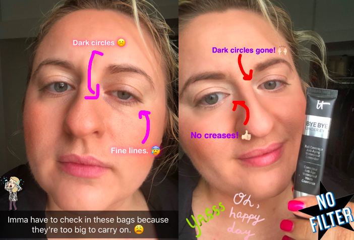 on the left buzzfeed writer's face with arrows pointing to her dark under eye circles and fine lines, on the right the same writer wearing the concealer with arrows pointing to no eye circles or lines