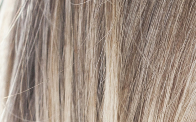 Can You Tell If These Pictures Are Of Human Hair Or Dog Hair