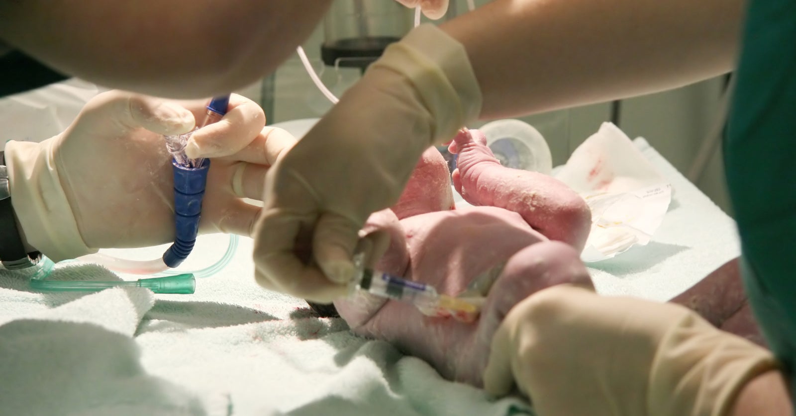 Despite What AntiVaxxers Say, Vitamin K Shots Are Safe For Newborns