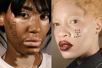 Esta incrível série de fotos prova que somos todos bonitos e que a ideia de uma "pele perfeita" não faz sentido