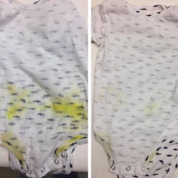 17 Of The Best Stain Removers You Can Get On Amazon