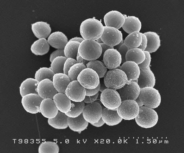 おにぎり食中毒の黒幕 黄色ブドウ球菌 について専門家に詳しく教えてもらいました
