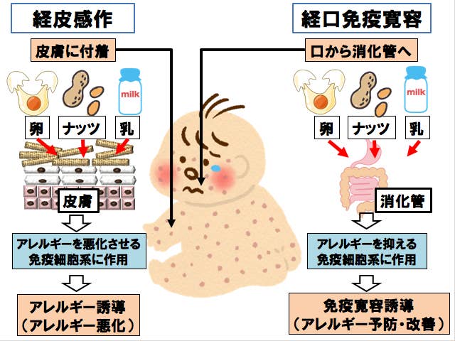 離乳食は 早く始める 遅らせる