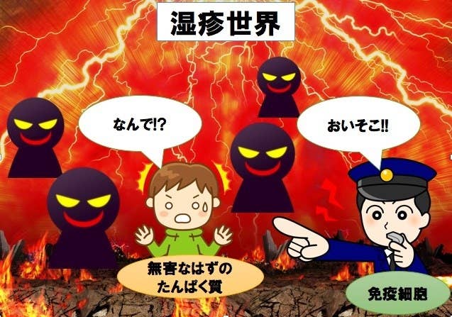 離乳食は 早く始める 遅らせる