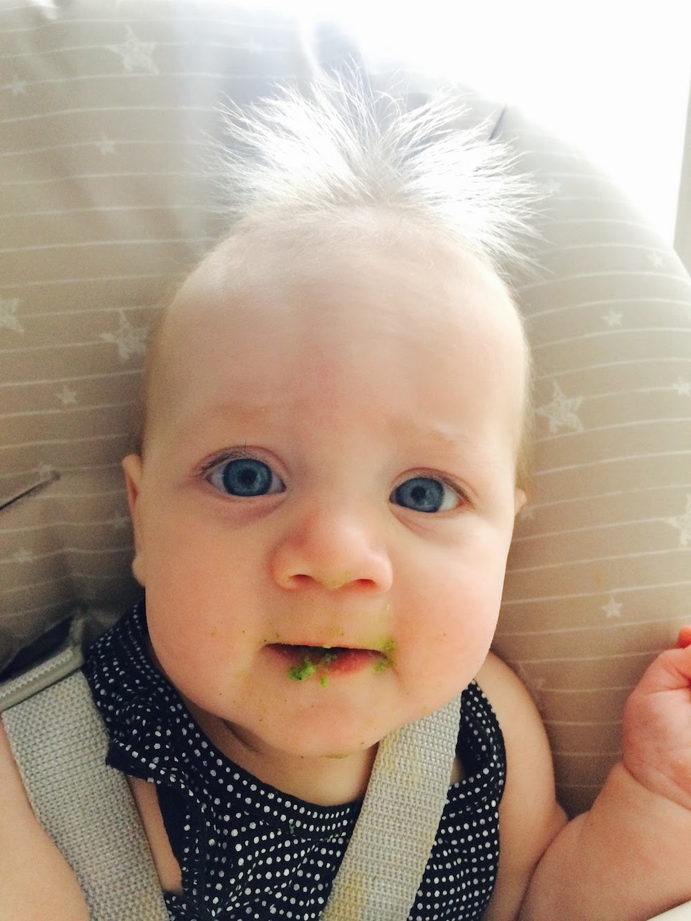 Uncombable Hair Syndrome Is A Real, Super-Rare Genetic Condition And This  Baby Has It