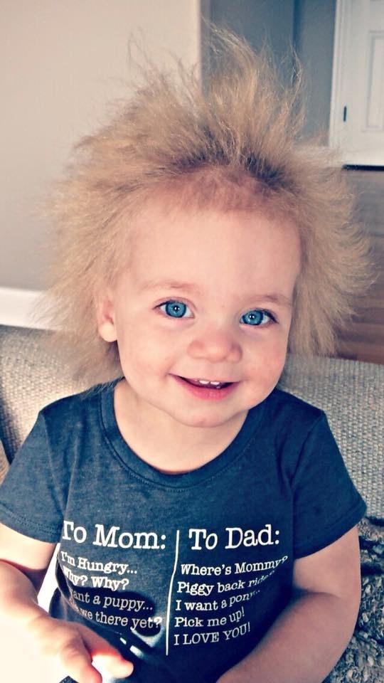 Uncombable Hair Syndrome Is Real and This Girl Has It