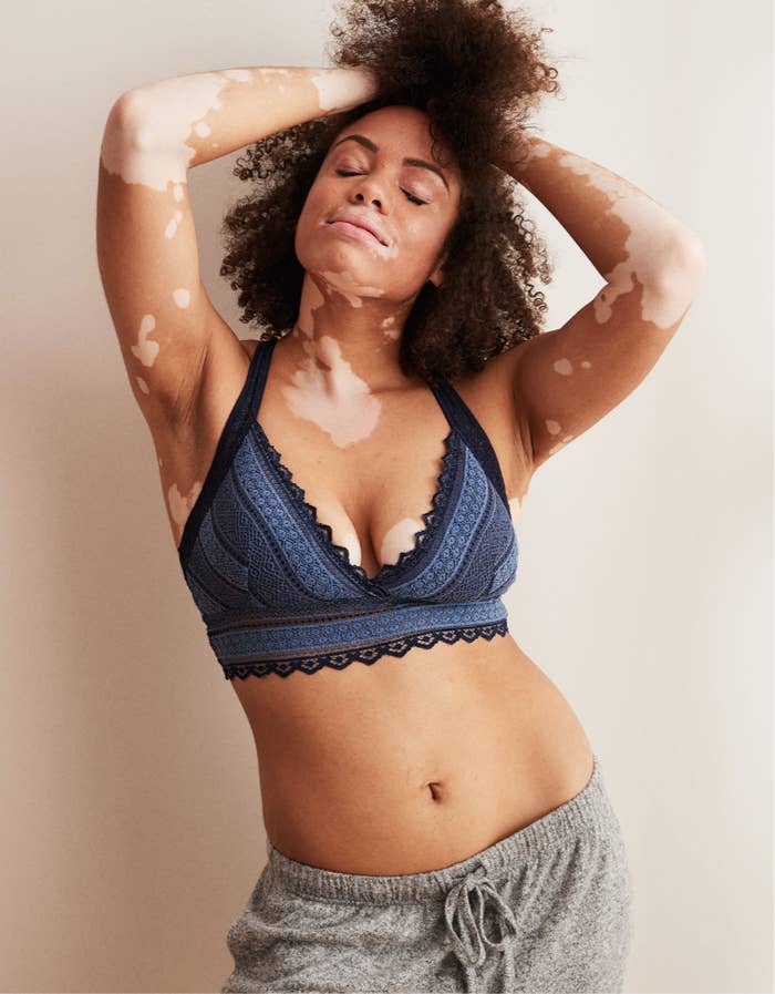 Aerie not only refuses to retouch any of their photos, but they're truly  inclusive with their models. their latest line features a model with a  colostomy bag. : r/Instagramreality