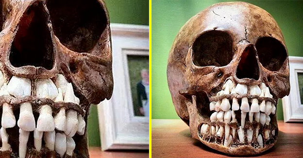Baby's skull clearance teeth