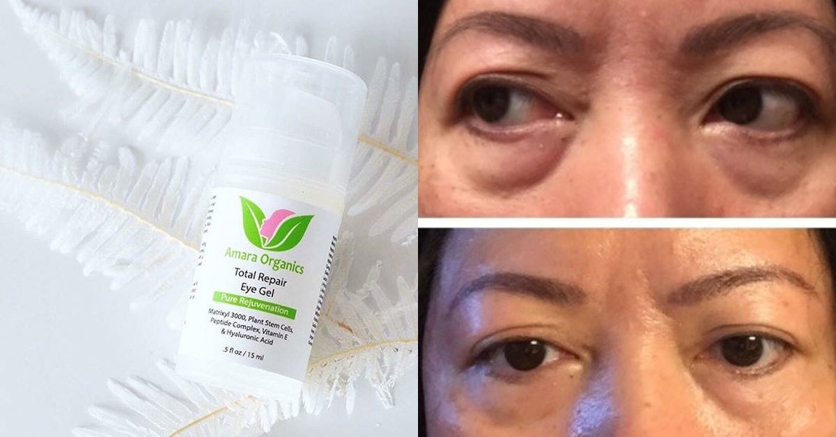 18 Of The Best Eye Creams You Can Get On Amazon