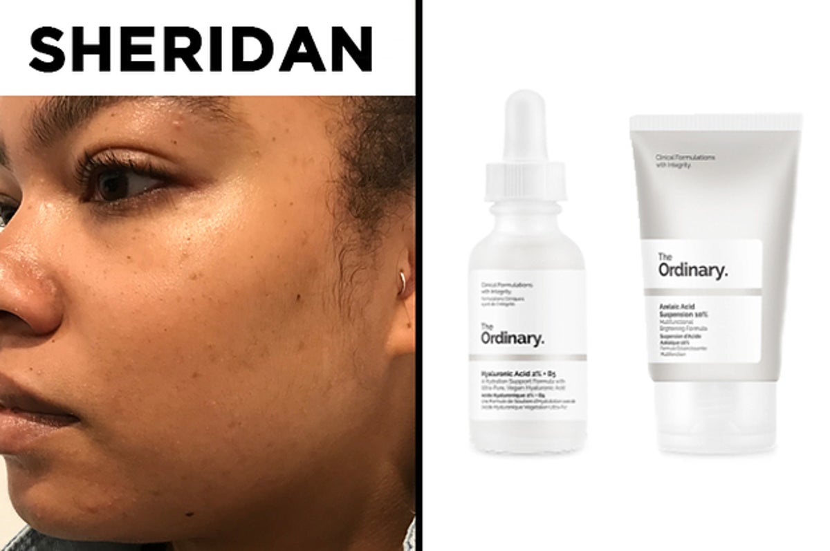 We Tried The Ordinary Skincare Line The Internet Is Talking