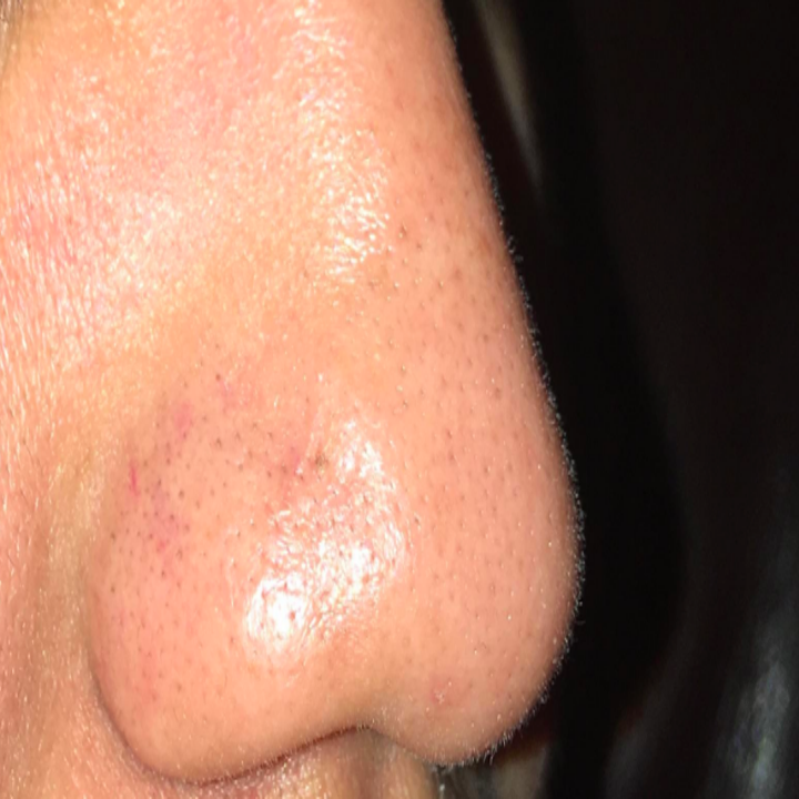 These Amazingly Satisfying Pore Strips Are A Cult Favorite For A Reason