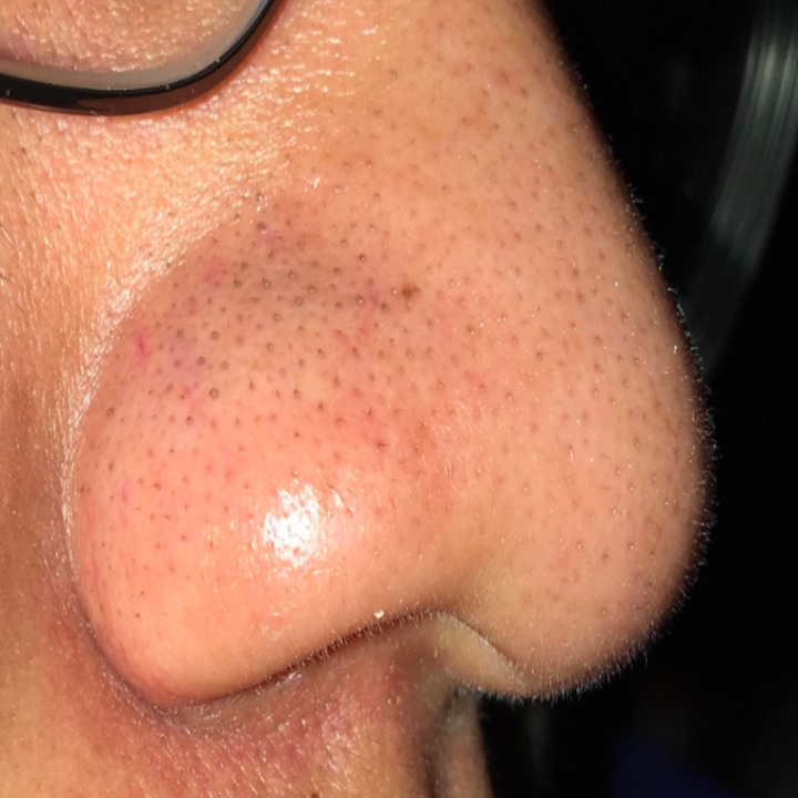 These Amazingly Satisfying Pore Strips Are A Cult Favorite For A Reason