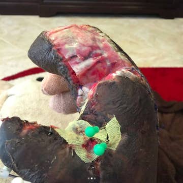NFL Star Jason Pierre-Paul Shared INCREDIBLY Graphic Photos Of His