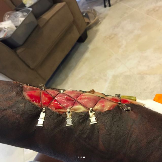 Jason Pierre-Paul Reportedly Has Finger Amputated After Fireworks Accident, News, Scores, Highlights, Stats, and Rumors