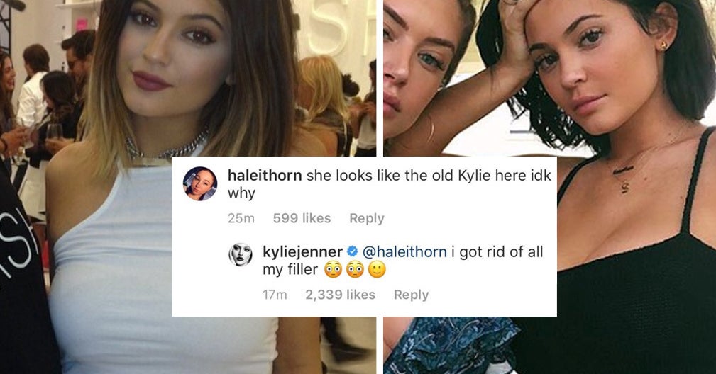 Guys Kylie Jenner Has Officially Removed Her Lip Fillers