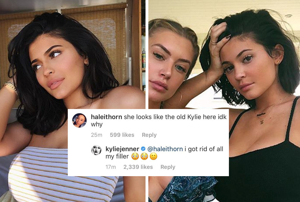 Kylie Jenner reveals she has had all her lip fillers removed