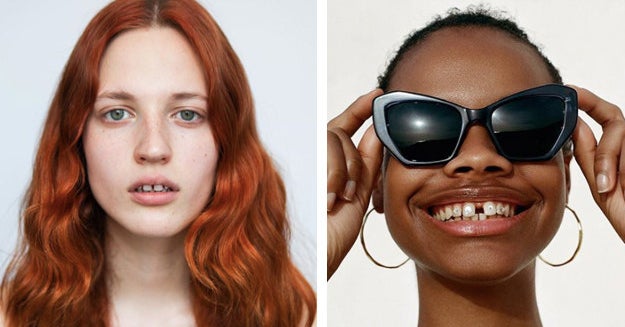 Brown teen big ass with braces 19 Models Who Prove That Gap Teeth Don T Always Need Braces